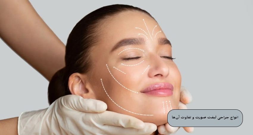 انواع جراحی لیفت صورت و تفاوت آن‌ها