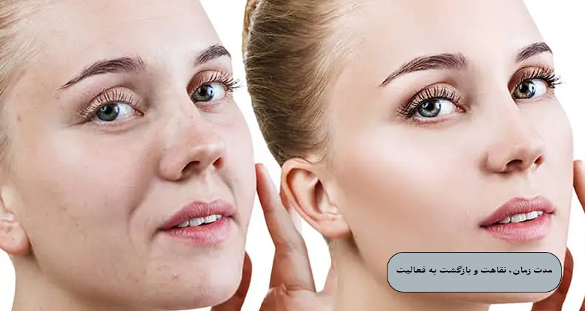 مدت زمان، نقاهت و بازگشت به فعالیت