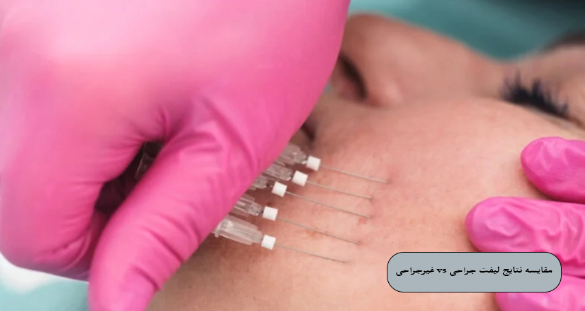 مقایسه نتایج لیفت جراحی vs غیرجراحی