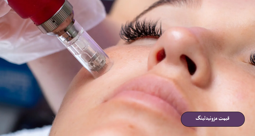 قیمت مزونیدلینگ