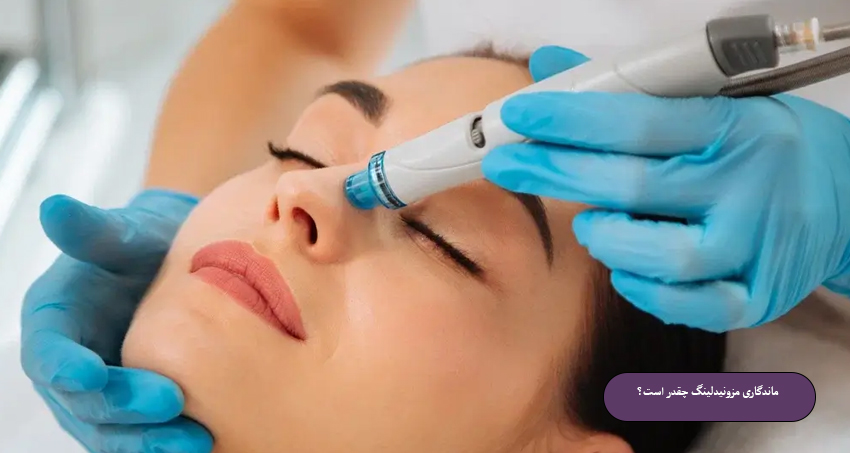 ماندگاری مزونیدلینگ چقدر است؟