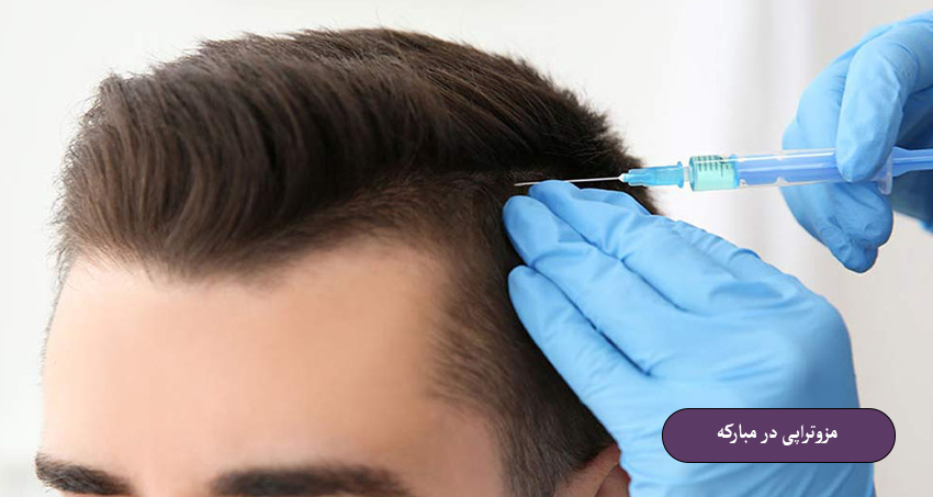 مزوتراپی در مبارکه