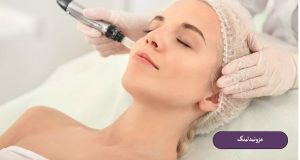 مزونیدلینگ