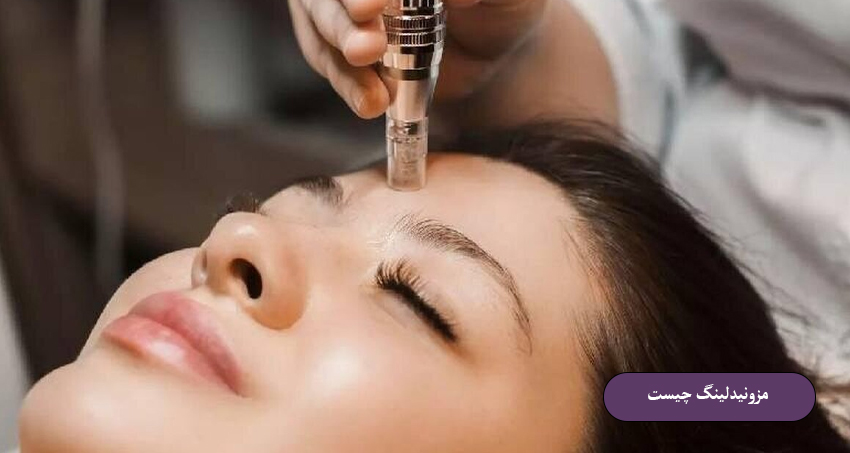 مزونیدلینگ چیست