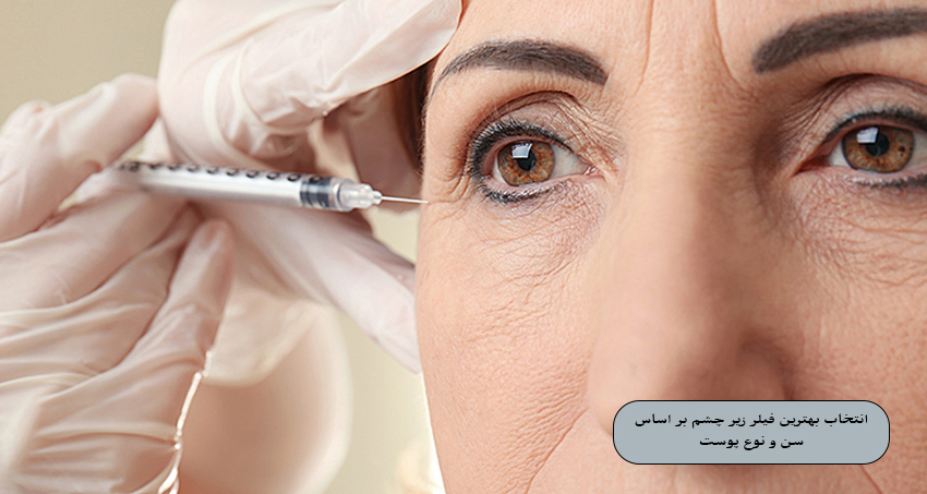 انتخاب بهترین فیلر زیر چشم بر اساس سن و نوع پوست