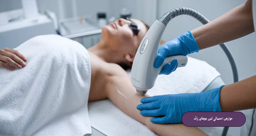 عوارض احتمالی لیزر موهای زائد