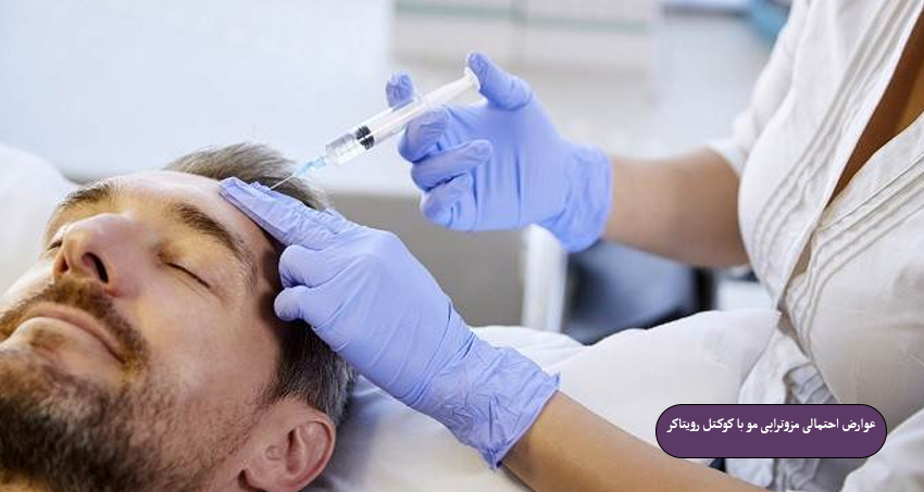 عوارض احتمالی مزوتراپی مو با کوکتل رویتاکر 