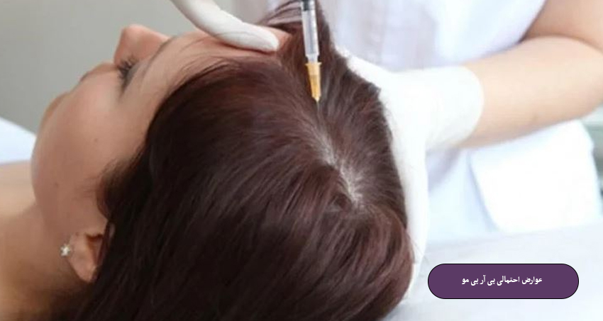 عوارض احتمالی پی آر پی مو