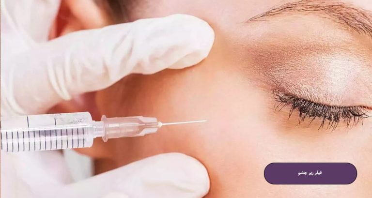 فیلر زیر چشم