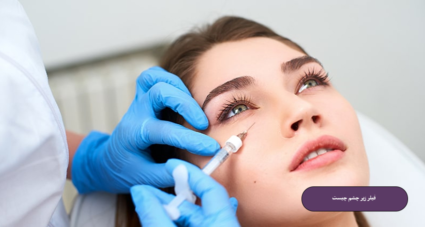 فیلر زیر چشم چیست