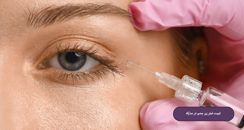 قیمت فیلر زیر چشم در مبارکه