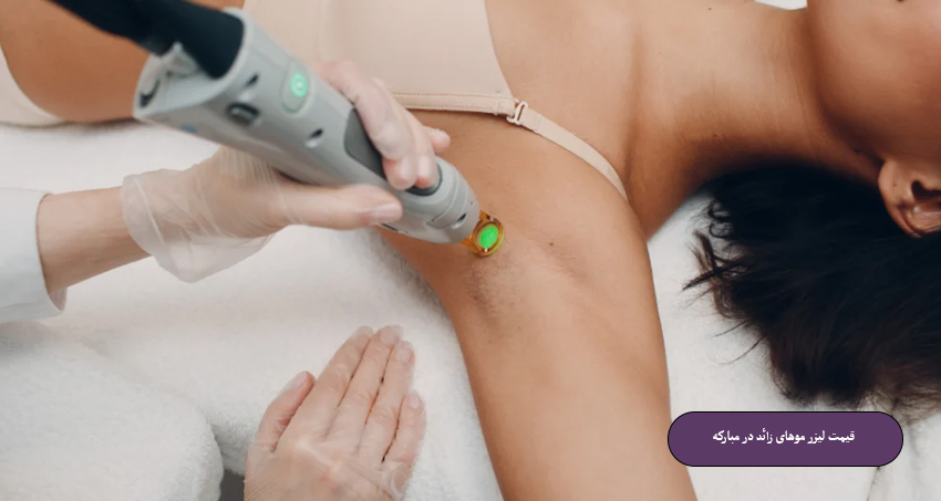 قیمت لیزر موهای زائد در مبارکه