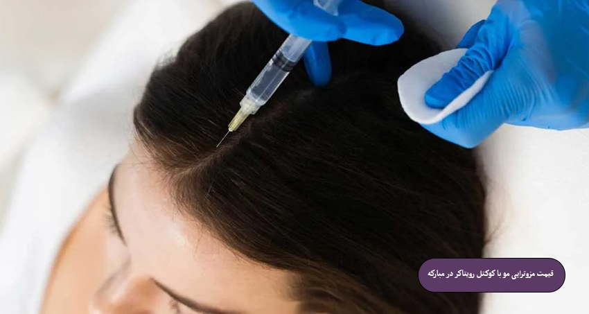 قیمت مزوتراپی مو با کوکتل رویتاکر در مبارکه (۱۴۰۴)