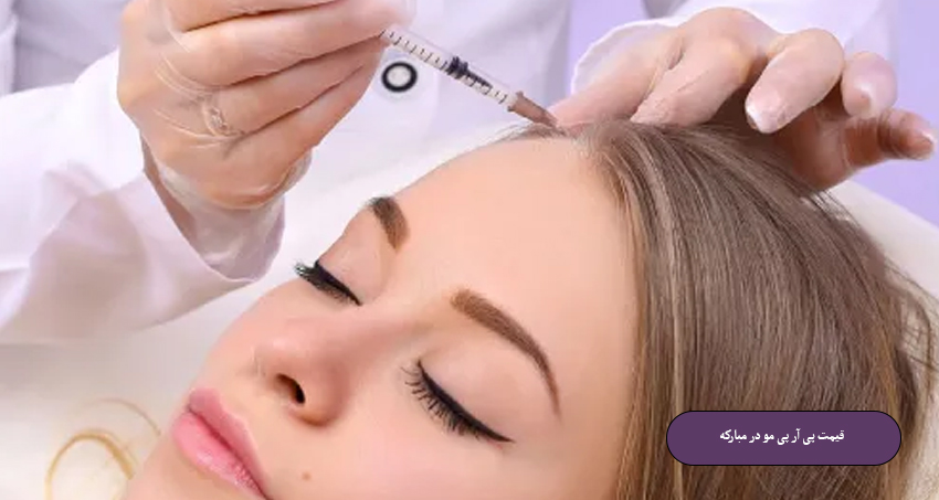 قیمت پی آر پی مو در مبارکه