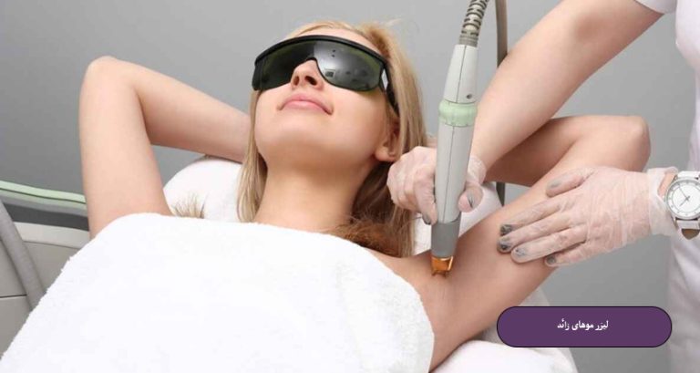 لیزر موهای زائد