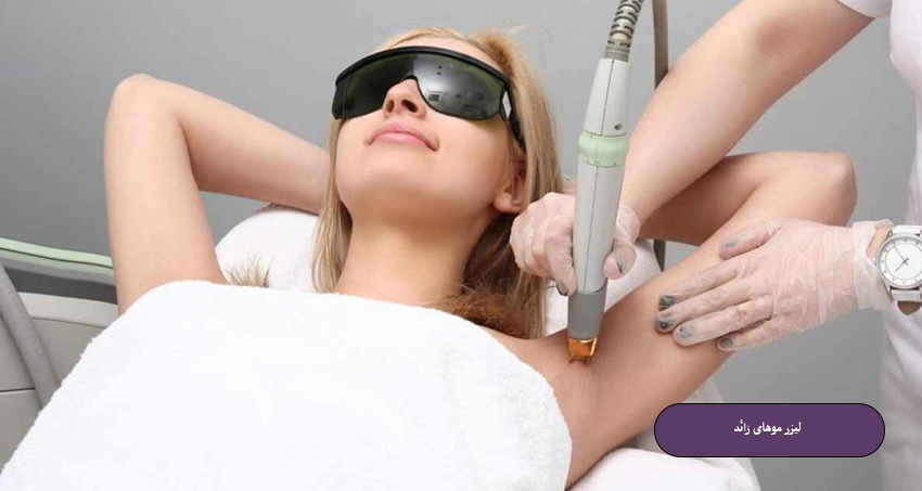 لیزر موهای زائد