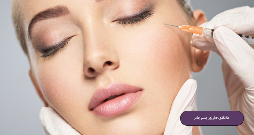 ماندگاری فیلر زیر چشم چقدر