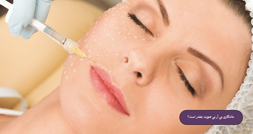 ماندگاری پی آر پی صورت چقدر است؟