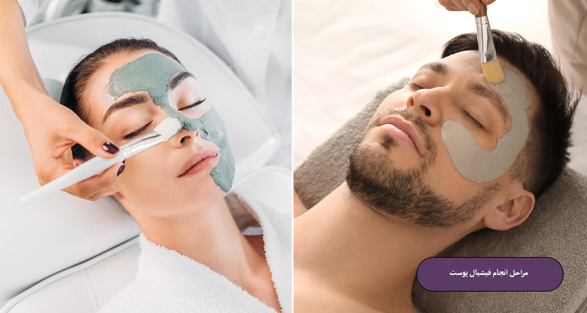 مراحل انجام فیشیال پوست