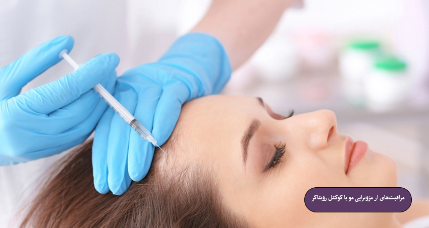 مراقبت‌های از مزوتراپی مو با کوکتل رویتاکر