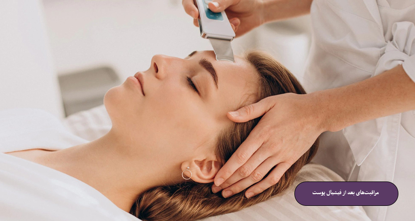 مراقبت‌های بعد از فیشیال پوست