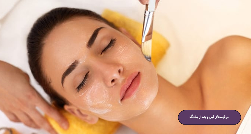 مراقبت‌های قبل و بعد از پیلینگ