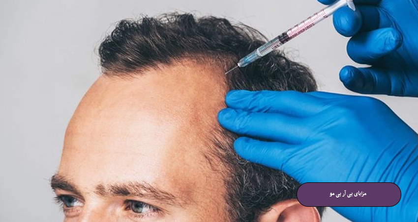 مزایای پی آر پی مو