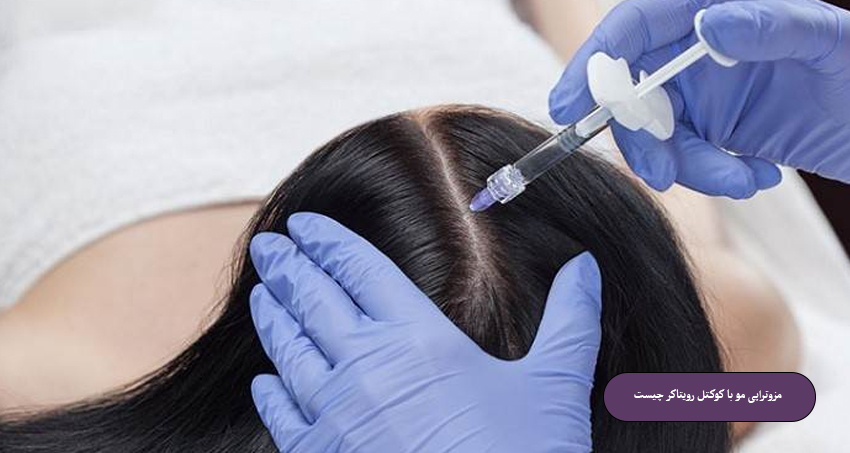 مزوتراپی مو با کوکتل رویتاکر چیست