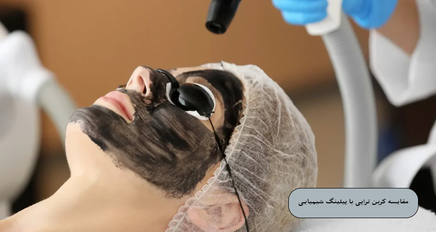مقایسه کربن تراپی با پیلینگ شیمیایی