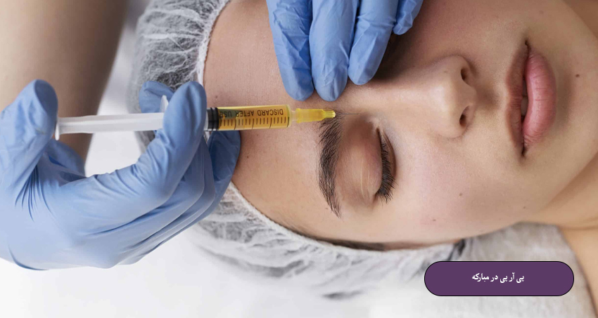 پی آر پی در مبارکه