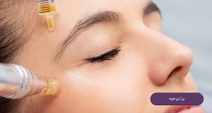 پی آر پی صورت