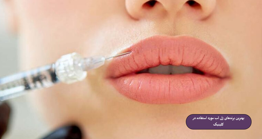 بهترین-برندهای-ژل-لب-مورد-استفاده-در-کلینیک