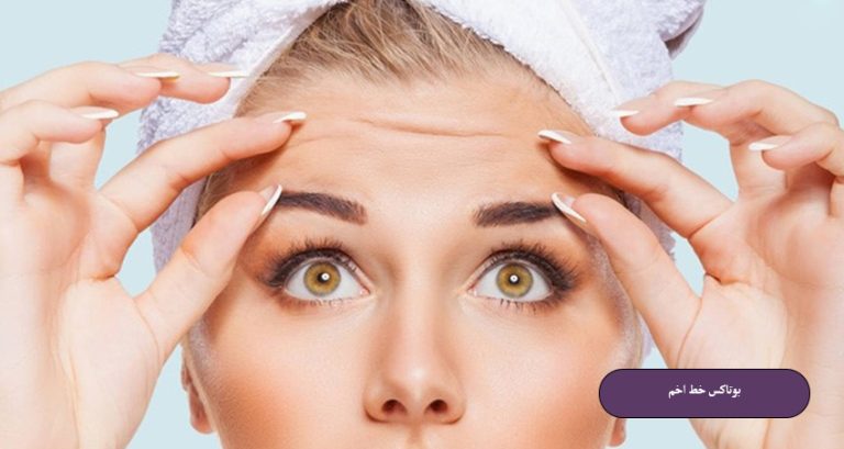 بوتاکس خط اخم