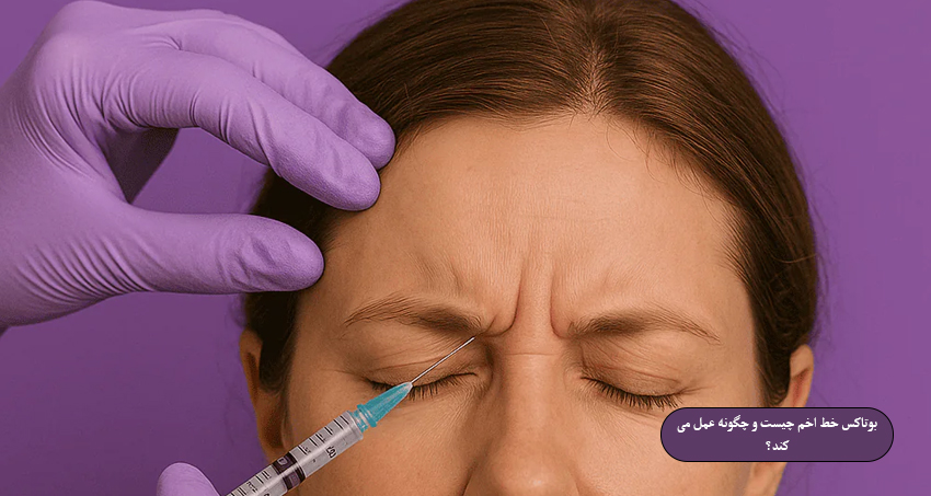 بوتاکس خط اخم چیست