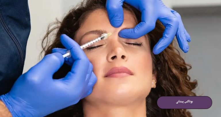 بوتاکس پیشانی