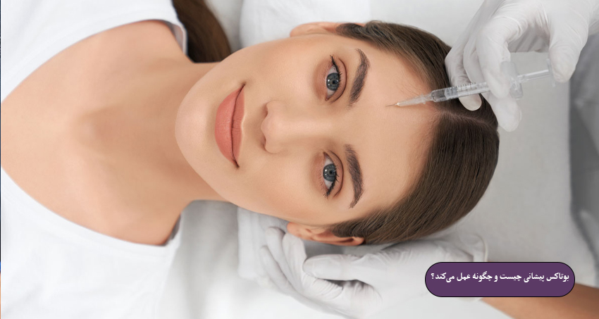 بوتاکس پیشانی چیست