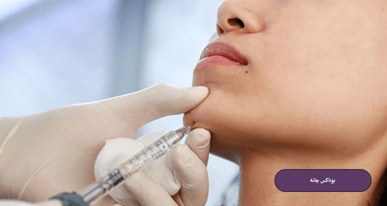 بوتاکس چانه