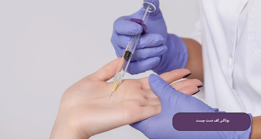 بوتاکس کف دست چیست