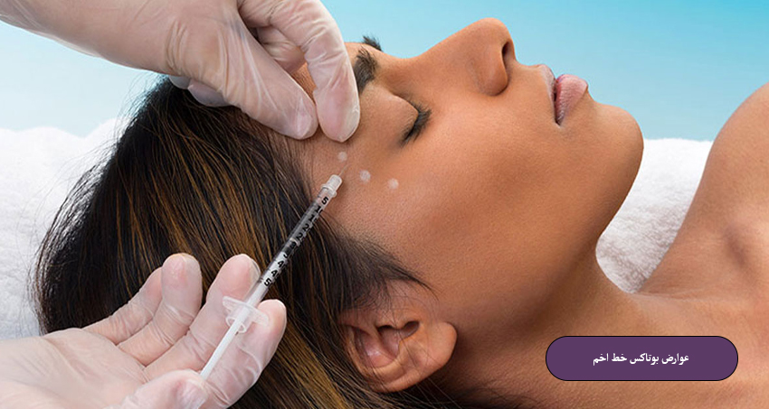 عوارض بوتاکس خط اخم