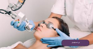 لیزر CO2 فرکشنال