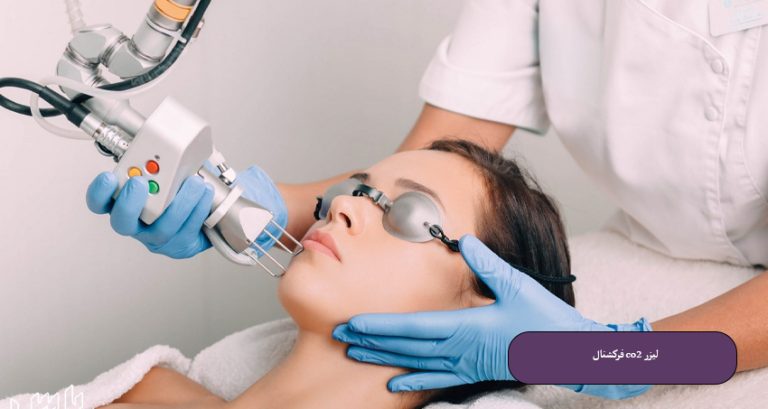 لیزر CO2 فرکشنال