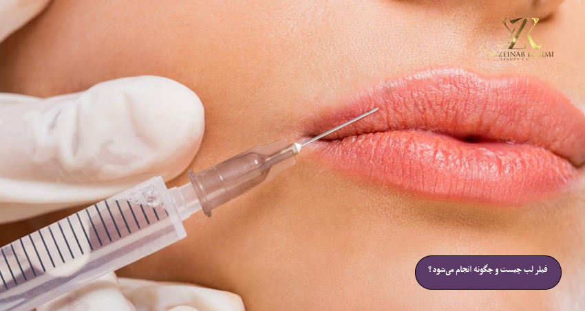فیلر لب طبیعی