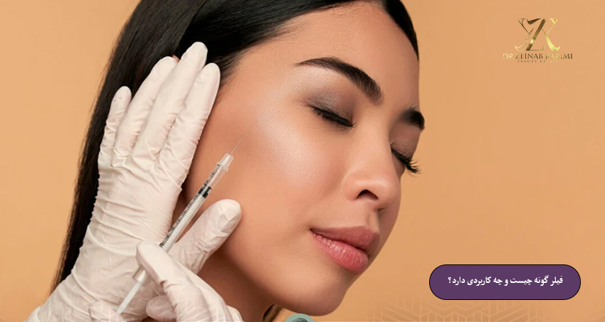 فیلر-گونه-چیست