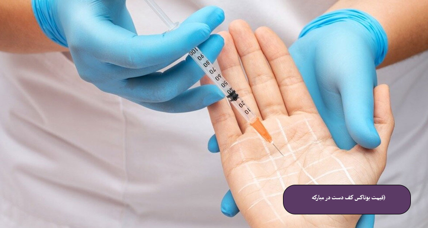 قیمت-بوتاکس-کف-دست-در-مبارکه-(۱۴۰۴)