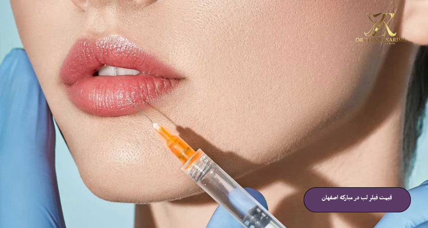 قیمت-فیلر-لب-در-مبارکه-اصفهان