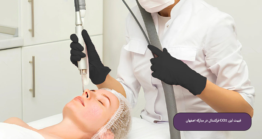 قیمت-لیزر-CO2-فرکشنال-در-مبارکه-اصفهان