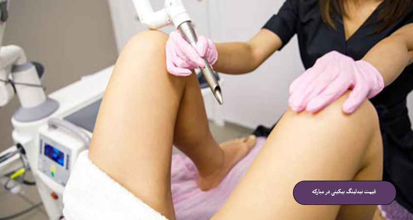 قیمت نیدلینگ بیکینی در مبارکه