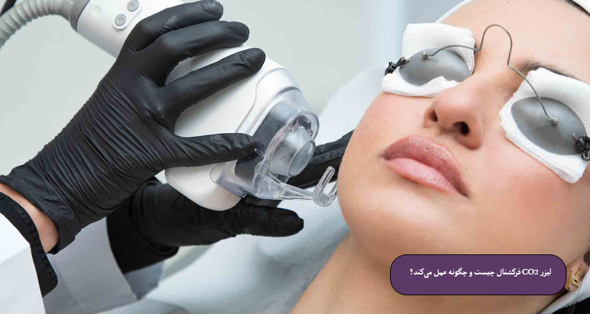 لیزر-CO2-فرکشنال-چیست-و-چگونه-عمل-می‌کند؟