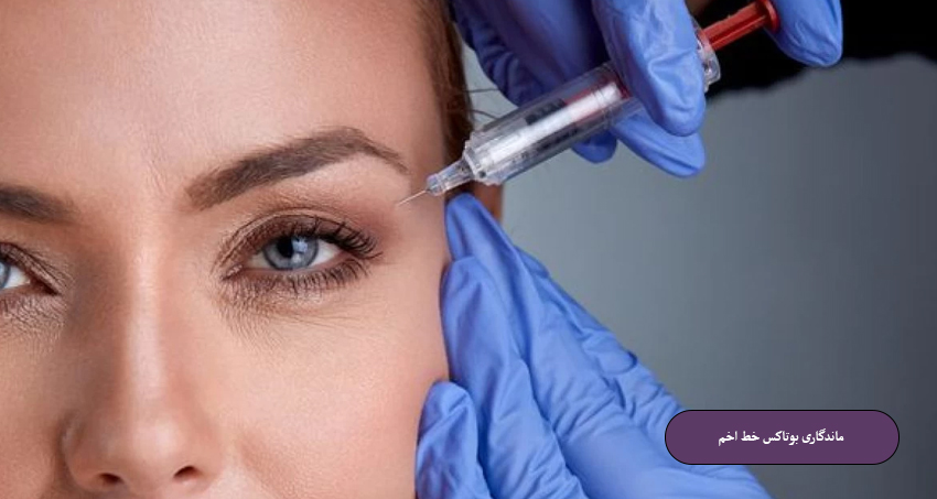 ماندگاری بوتاکس خط اخم