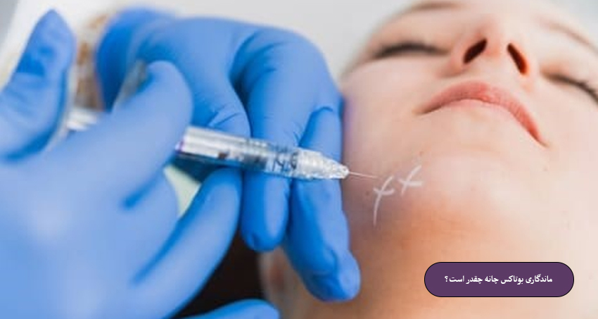 ماندگاری بوتاکس چانه